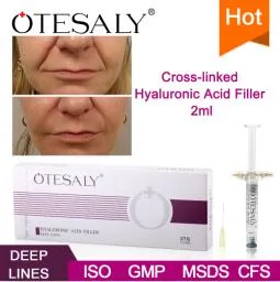 Otesaly 2ml Hyaluronic Acid Injectable Dermal Filler for Deep Wrinkles Nasolabial Folds 