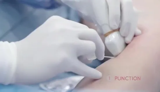 Germany Leg Vein Varicose Removal Treatment 980nm 1470nm Diode Laser Vein Care Evlt Machine 