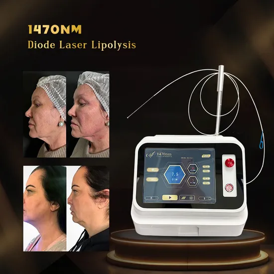 2025 Top Sales Most Effective Skin Rejuvenation Endolaser Liposuction Equipment 1470 Nm Endolaser Liposuction Surgery 