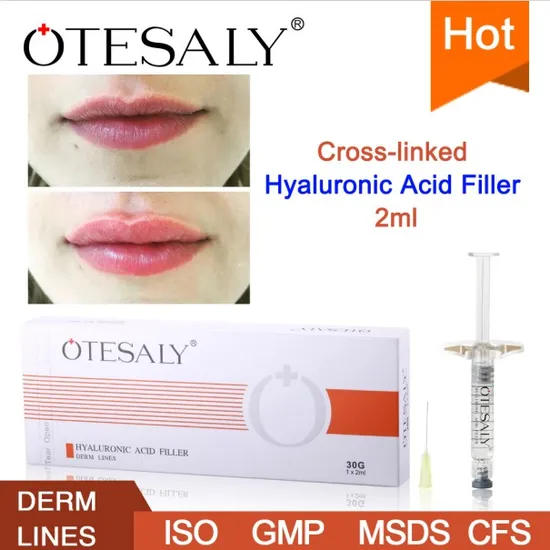 High Quality Dermal Filler Otesaly Manufacturer 2ml Derm Lines Injectable Hyaluronic Acid Filler for Lips and Fine Lines 
